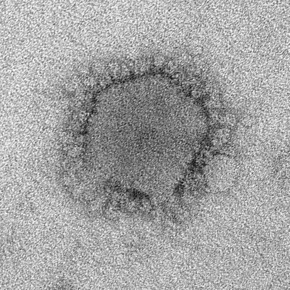 سومین مورد عفونت با ویروس مرس در آمریکا شناسایی شد