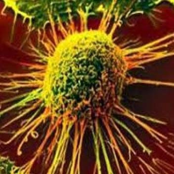 روش تازه توقف رشد سلول‌های سرطانی