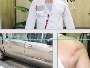 مهاجمان علاوه بر مجروح کردن کارکنان شهرداری، به خودروی سد معبر نیز آسیب وارد کردند.