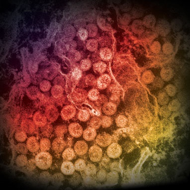 ثبت ۱۸مورد جدید ابتلا به کرونا ویروس در عربستان