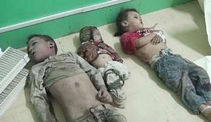 کودکان یمنی کشته شده در جنگ