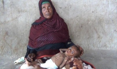 سازمان ملل: ۱۳ استان یمن در معرض گرسنگی قرار دارد