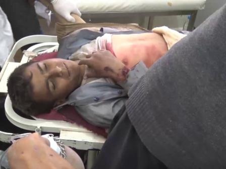 شمار کشته های حمله هوایی عربستان به استان صعده یمن به ۲۶ تن افزایش یافت
