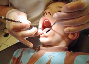 مهمترین علت پوسیدگی دندان‌های ایرانی‌ها