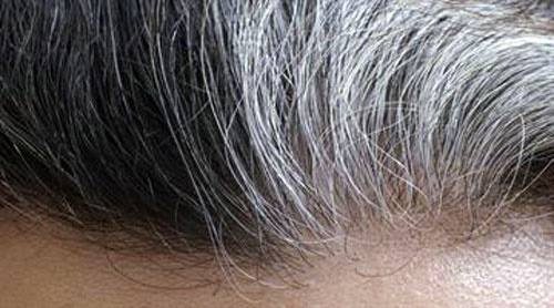 تغییر ظاهر موها، خبر از کدام بیماری‌ها می‌دهد؟