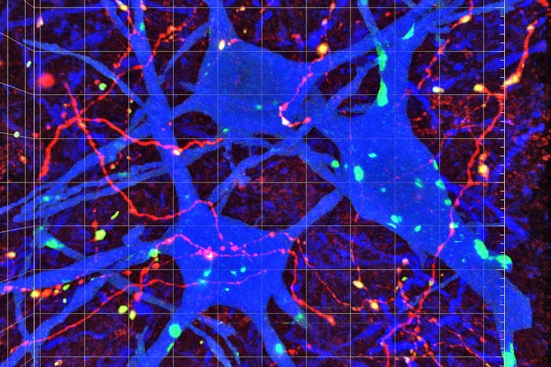 نقشه اتصالات عصبی مغز