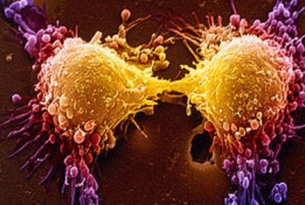 استفاده از «تستوسترون» برای درمان موفقیت‌آمیز سرطان