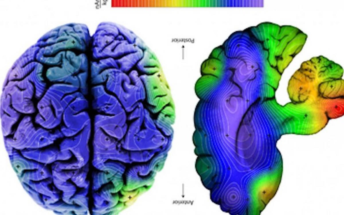 نقشه ذرات مغناطیسی مغز انسان