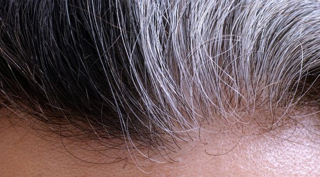 علت واقعی سفید شدن موها چیست؟ آیا می‌توان رنگ موهای سفید شده را به طور دائم بازگرداند؟