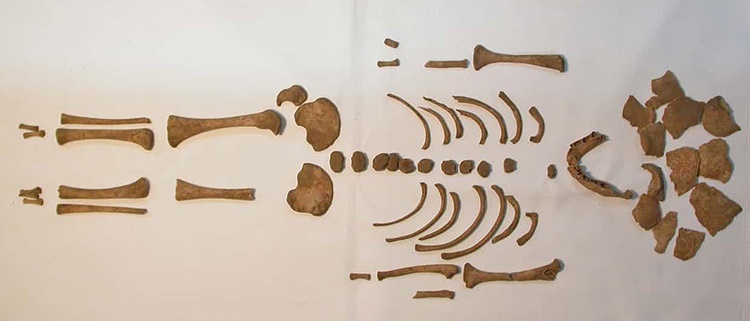 نرمی استخوان در روم باستان