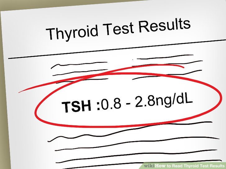 THYROID TEST